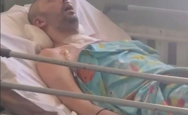 Украинцы имеют право знать, кто их&nbsp;бьет: омбудсмен возмущен, житель Днепра в&nbsp;коме